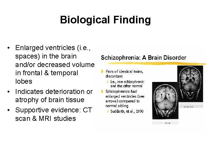 Biological Finding • Enlarged ventricles (i. e. , spaces) in the brain and/or decreased