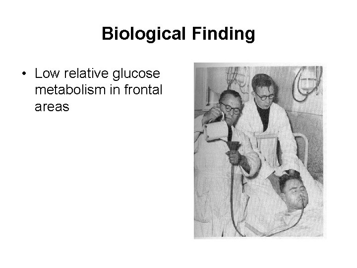 Biological Finding • Low relative glucose metabolism in frontal areas 