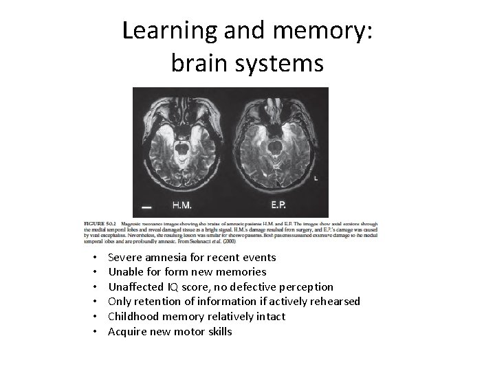 Learning and memory: brain systems • • • Severe amnesia for recent events Unable