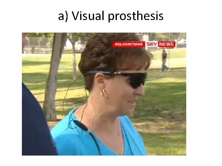a) Visual prosthesis 