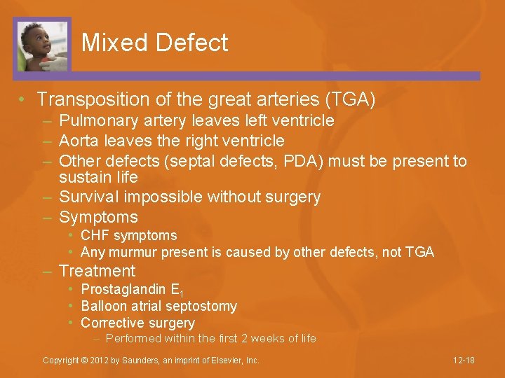 Mixed Defect • Transposition of the great arteries (TGA) – Pulmonary artery leaves left