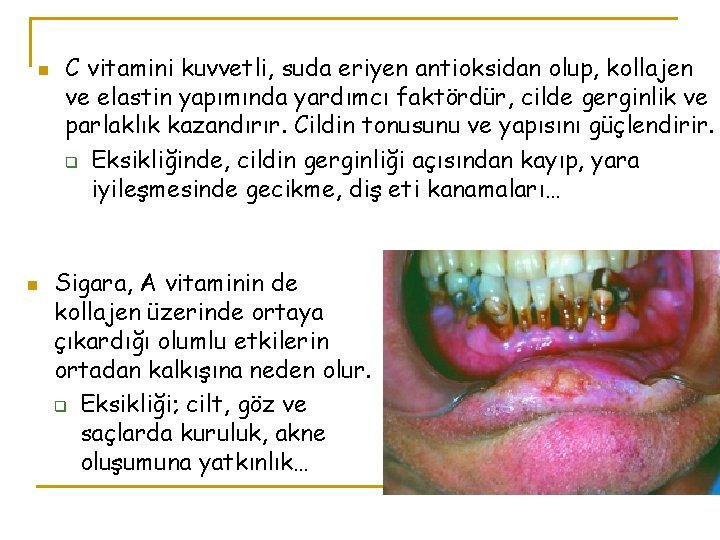 n n C vitamini kuvvetli, suda eriyen antioksidan olup, kollajen ve elastin yapımında yardımcı