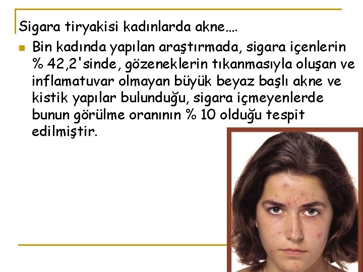 Sigara tiryakisi kadınlarda akne…. n Bin kadında yapılan araştırmada, sigara içenlerin % 42, 2'sinde,