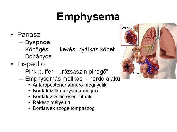 Emphysema • Panasz – Dyspnoe – Köhögés – Dohányos kevés, nyálkás köpet • Inspectio