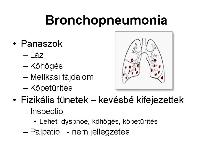 Bronchopneumonia • Panaszok – Láz – Köhögés – Mellkasi fájdalom – Köpetürítés • Fizikális Bronchopneumonia • Panaszok – Láz – Köhögés – Mellkasi fájdalom – Köpetürítés • Fizikális