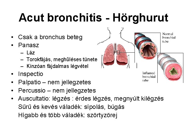 Acut bronchitis - Hörghurut • Csak a bronchus beteg • Panasz – Láz –