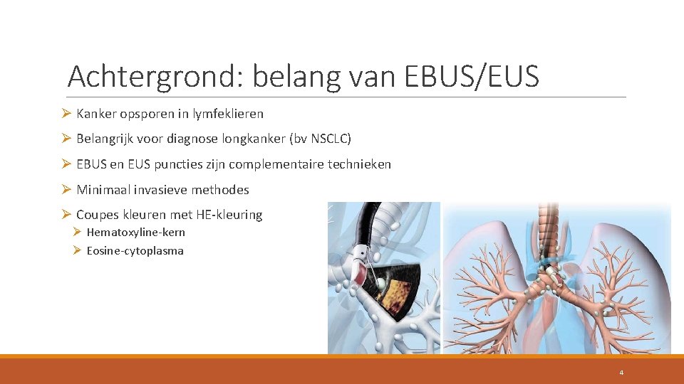 Achtergrond: belang van EBUS/EUS Ø Kanker opsporen in lymfeklieren Ø Belangrijk voor diagnose longkanker