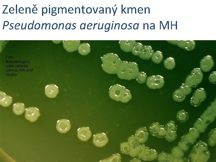 Zeleně pigmentovaný kmen Pseudomonas aeruginosa na MH Foto: Mikrobiologický ústav (stránky ústavu), foto prof.