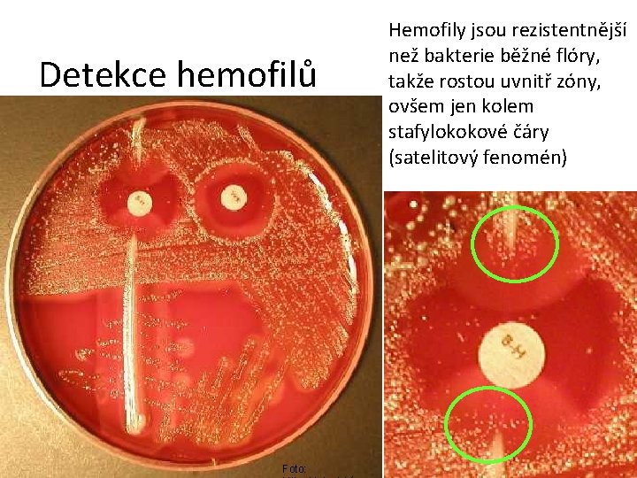 Detekce hemofilů Foto: Hemofily jsou rezistentnější než bakterie běžné flóry, takže rostou uvnitř zóny,