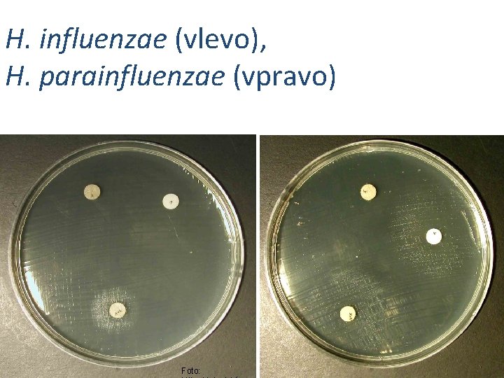 H. influenzae (vlevo), H. parainfluenzae (vpravo) Foto: 