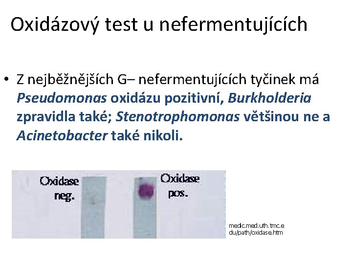 Oxidázový test u nefermentujících • Z nejběžnějších G– nefermentujících tyčinek má Pseudomonas oxidázu pozitivní,