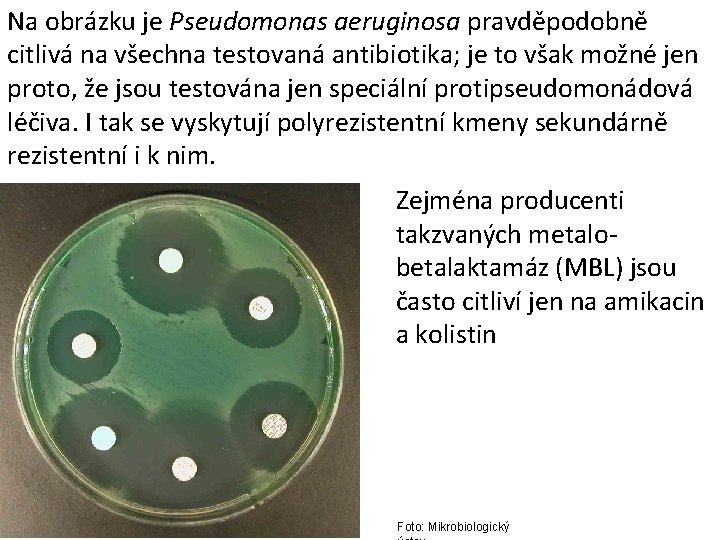 Na obrázku je Pseudomonas aeruginosa pravděpodobně citlivá na všechna testovaná antibiotika; je to však