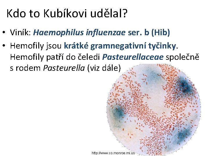 Kdo to Kubíkovi udělal? • Viník: Haemophilus influenzae ser. b (Hib) • Hemofily jsou