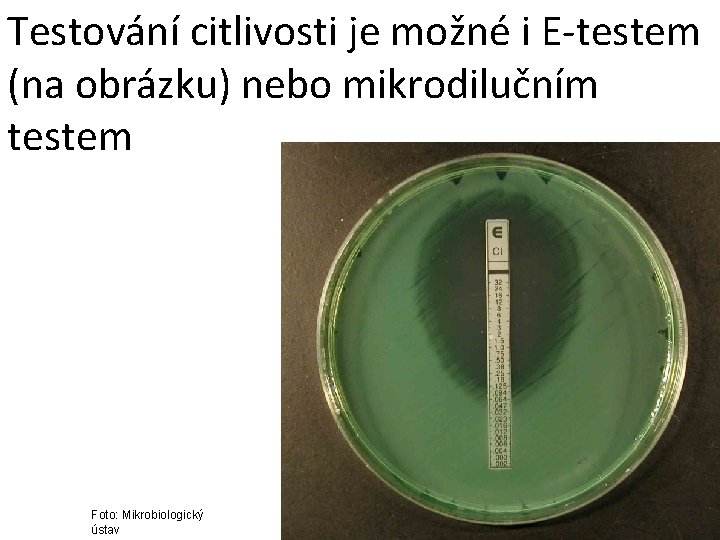 Testování citlivosti je možné i E-testem (na obrázku) nebo mikrodilučním testem Foto: Mikrobiologický ústav