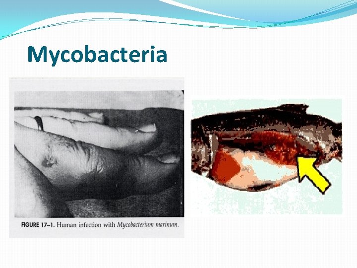 Mycobacteria 