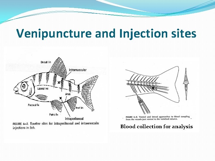 Venipuncture and Injection sites Blood collection for analysis 