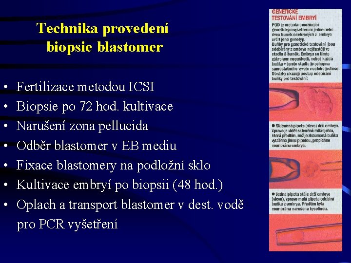 Technika provedení biopsie blastomer • Fertilizace metodou ICSI • Biopsie po 72 hod. kultivace