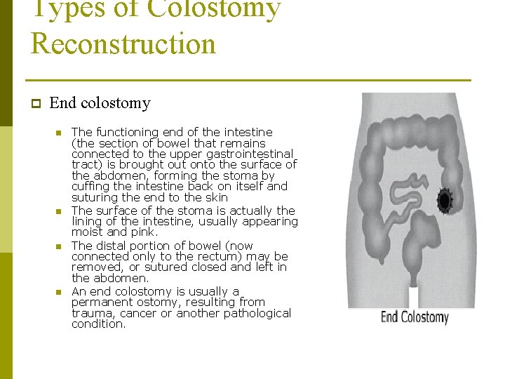 Types of Colostomy Reconstruction p End colostomy n n The functioning end of the Types of Colostomy Reconstruction p End colostomy n n The functioning end of the