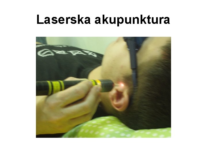 Laserska akupunktura 