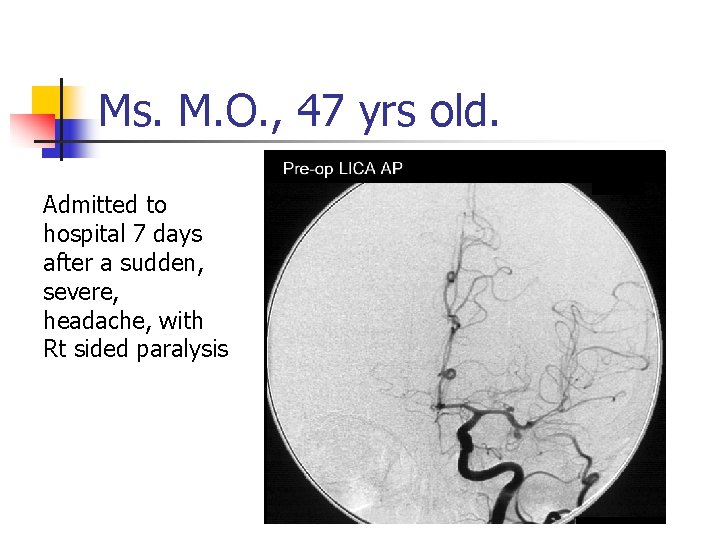 Ms. M. O. , 47 yrs old. Admitted to hospital 7 days after a