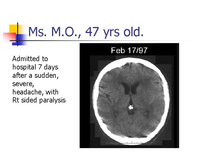 Ms. M. O. , 47 yrs old. Admitted to hospital 7 days after a