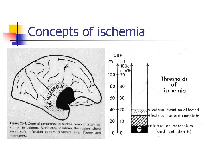 Concepts of ischemia 