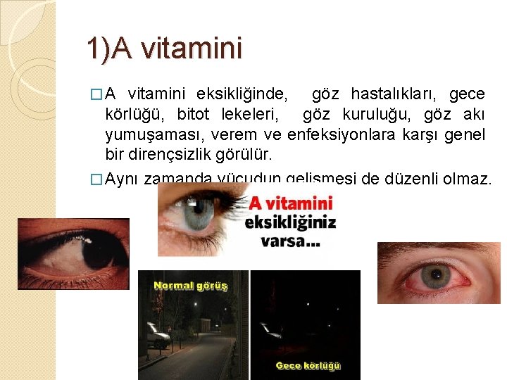 1)A vitamini � A vitamini eksikliğinde, göz hastalıkları, gece körlüğü, bitot lekeleri, göz kuruluğu,
