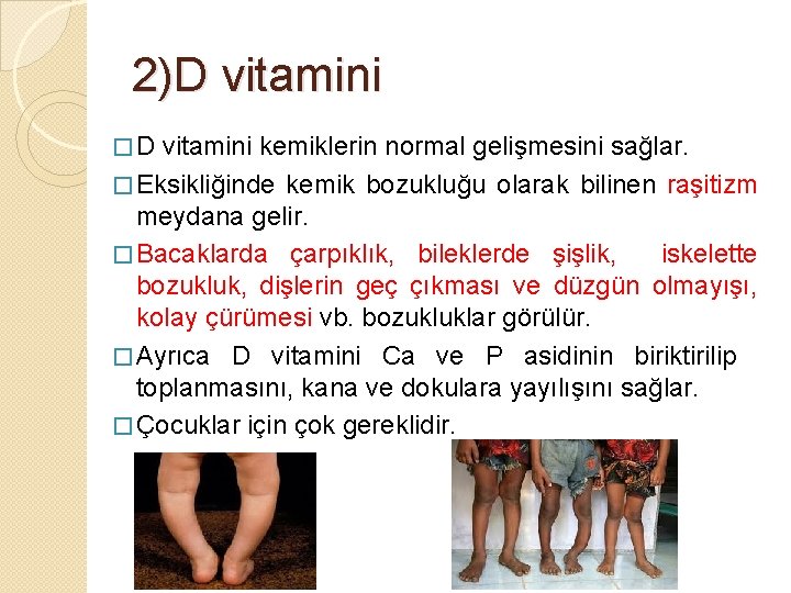 2)D vitamini � D vitamini kemiklerin normal gelişmesini sağlar. � Eksikliğinde kemik bozukluğu olarak