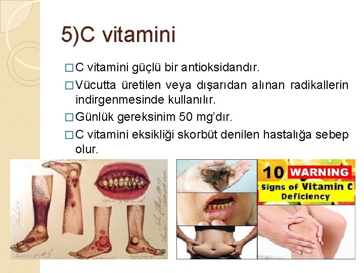 5)C vitamini � C vitamini güçlü bir antioksidandır. � Vücutta üretilen veya dışarıdan alınan