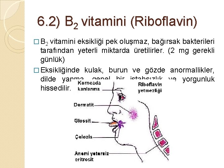 6. 2) B 2 vitamini (Riboflavin) � B 2 vitamini eksikliği pek oluşmaz, bağırsak