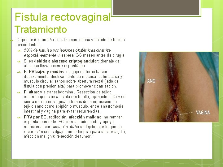 Fístula rectovaginal Tratamiento Depende del tamaño, localización, causa y estado de tejidos circundantes. 50%