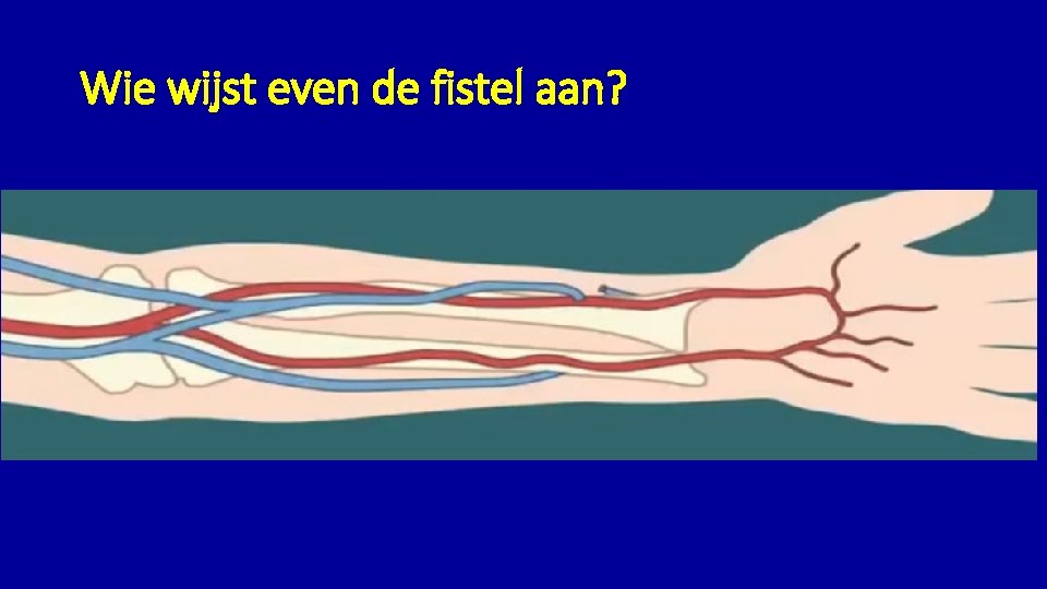 Wie wijst even de fistel aan? 
