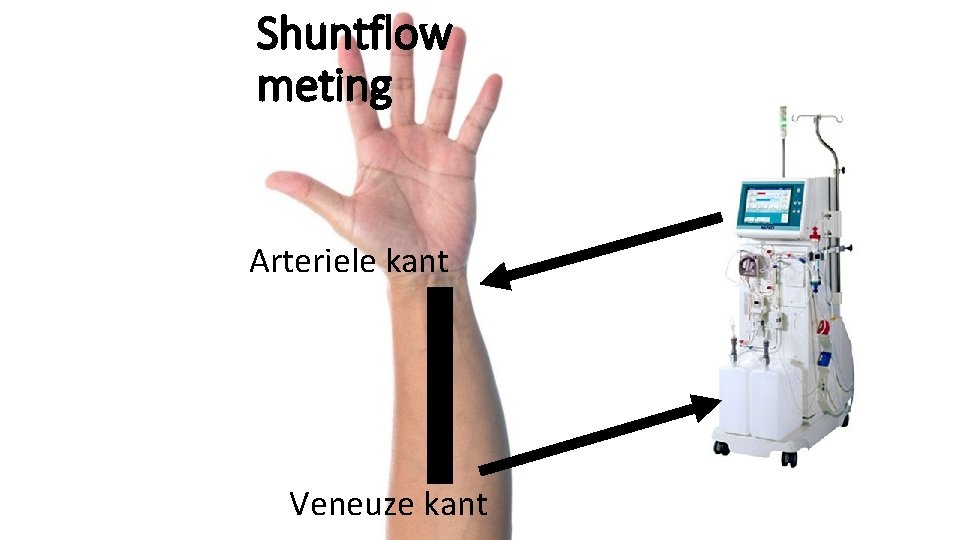 Shuntflow meting Arteriele kant Veneuze kant 