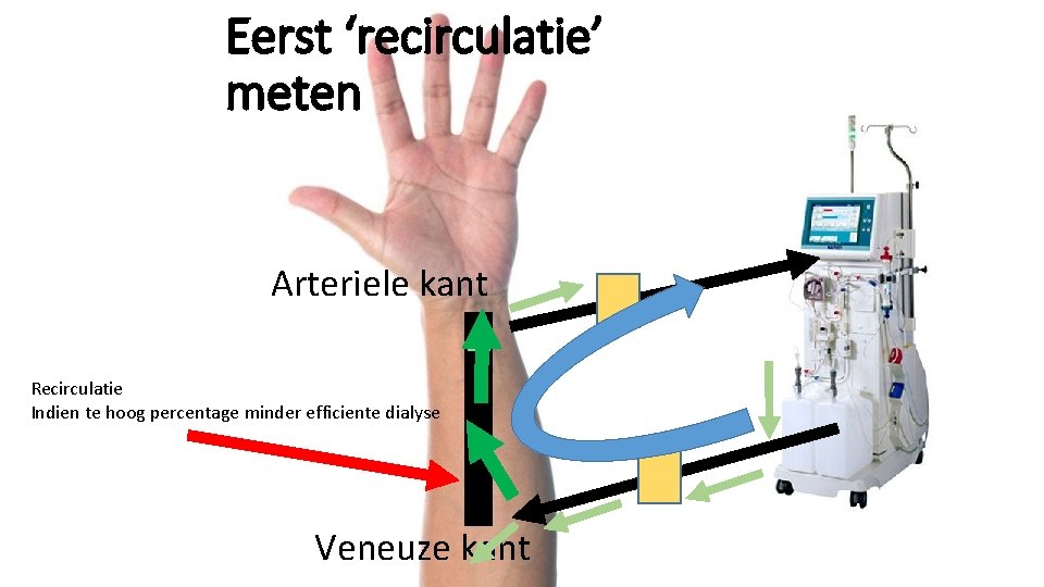 Eerst ‘recirculatie’ meten Arteriele kant Recirculatie Indien te hoog percentage minder efficiente dialyse Veneuze