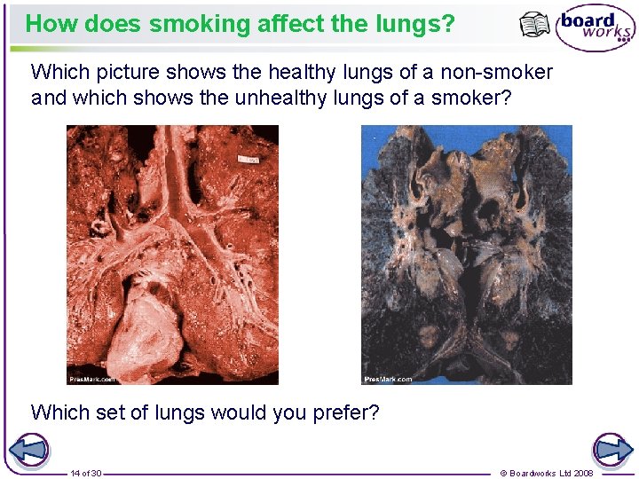 How does smoking affect the lungs? Which picture shows the healthy lungs of a