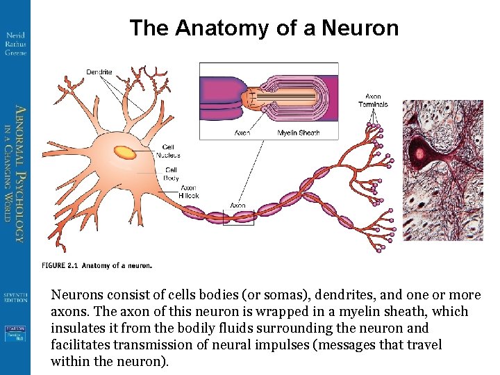 The Anatomy of a Neurons consist of cells bodies (or somas), dendrites, and one