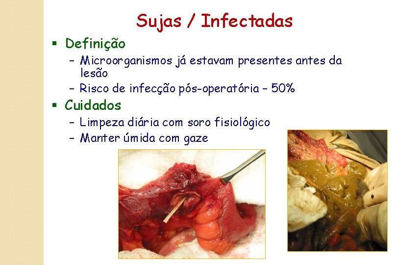 Sujas / Infectadas § Definição – Microorganismos já estavam presentes antes da lesão –