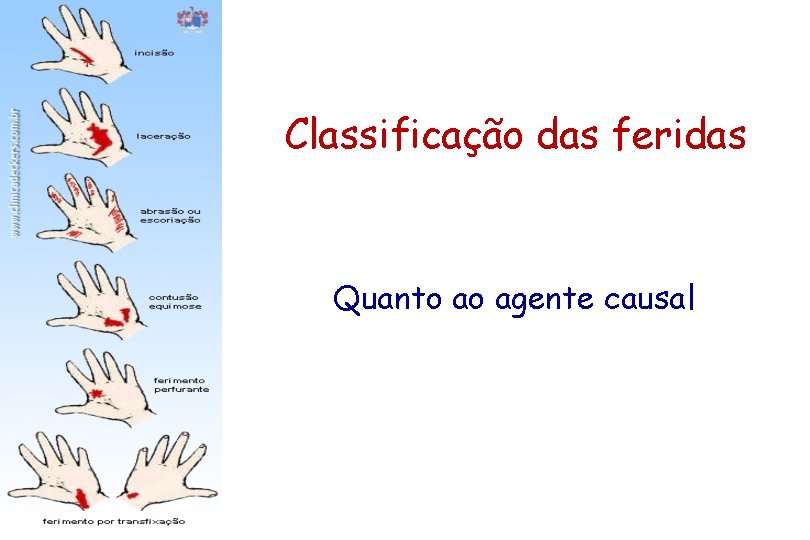 Classificação das feridas Quanto ao agente causal 