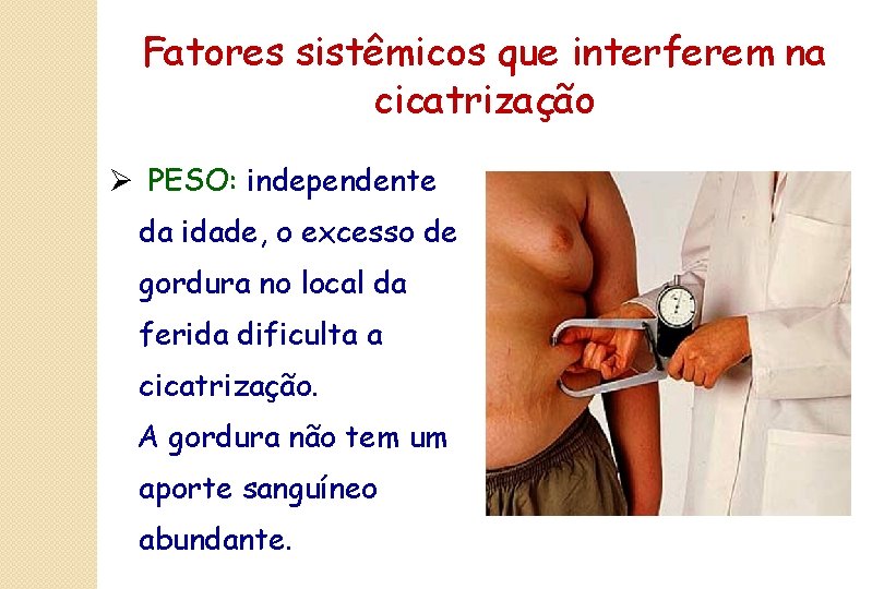 Fatores sistêmicos que interferem na cicatrização Ø PESO: independente da idade, o excesso de