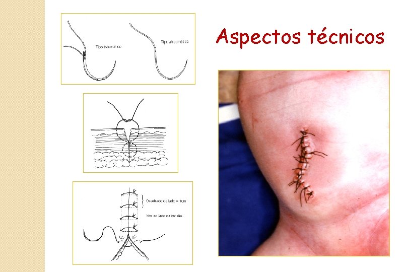 Aspectos técnicos 