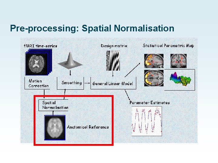 Pre-processing: Spatial Normalisation 