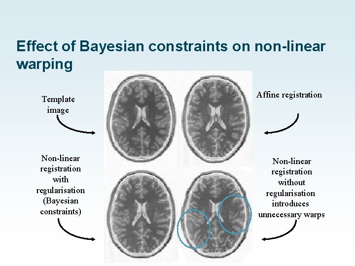 Effect of Bayesian constraints on non-linear warping Template image Affine registration Non-linear registration with Effect of Bayesian constraints on non-linear warping Template image Affine registration Non-linear registration with