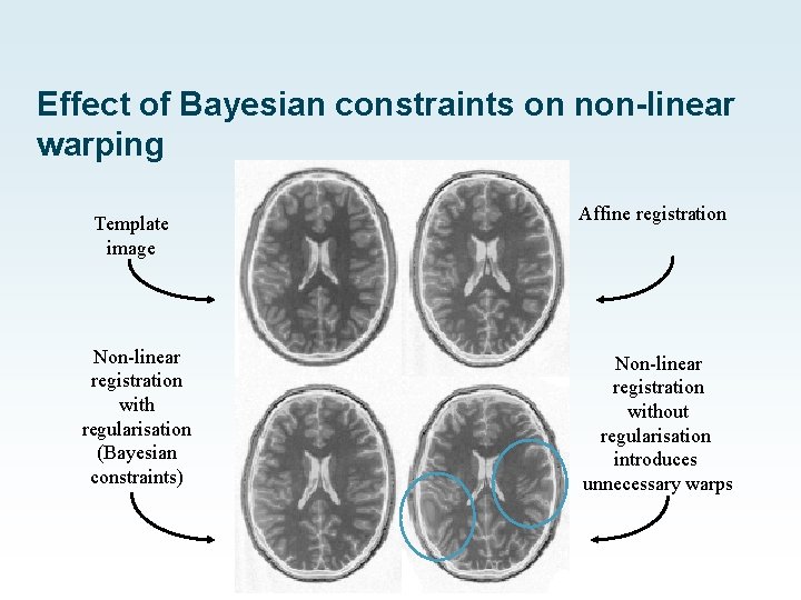 Effect of Bayesian constraints on non-linear warping Template image Affine registration Non-linear registration with