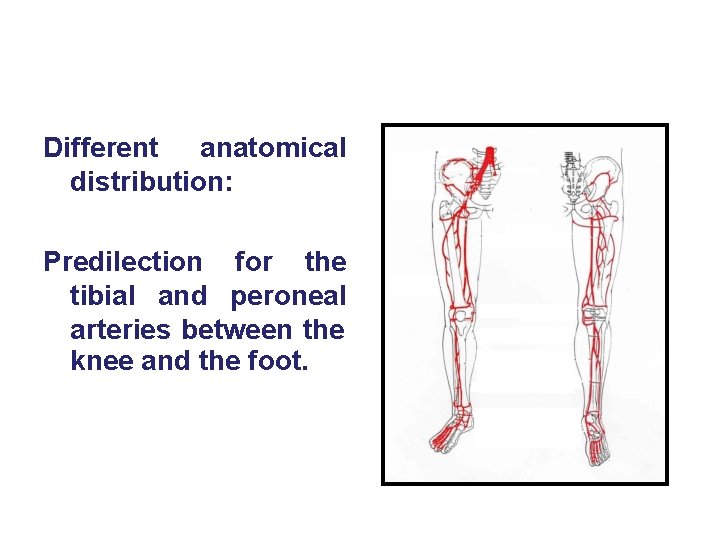 Different anatomical distribution: Predilection for the tibial and peroneal arteries between the knee and Different anatomical distribution: Predilection for the tibial and peroneal arteries between the knee and
