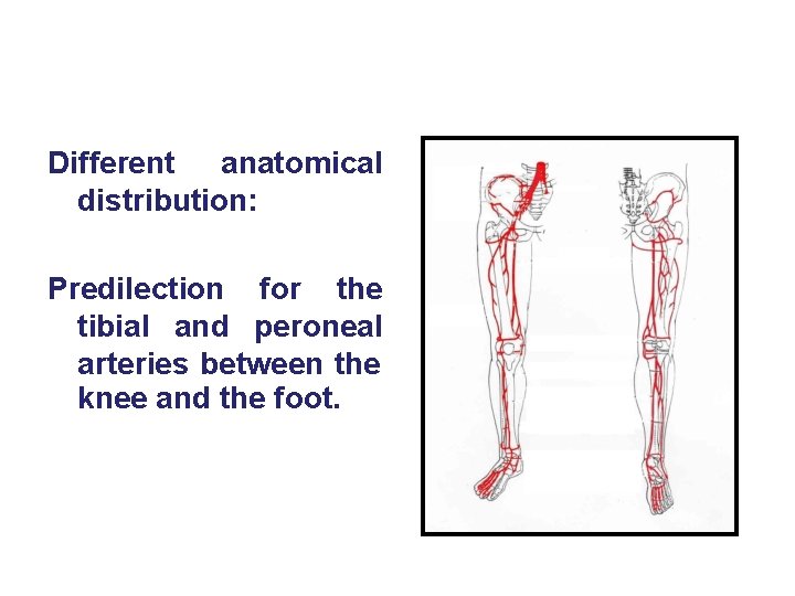 Different anatomical distribution: Predilection for the tibial and peroneal arteries between the knee and