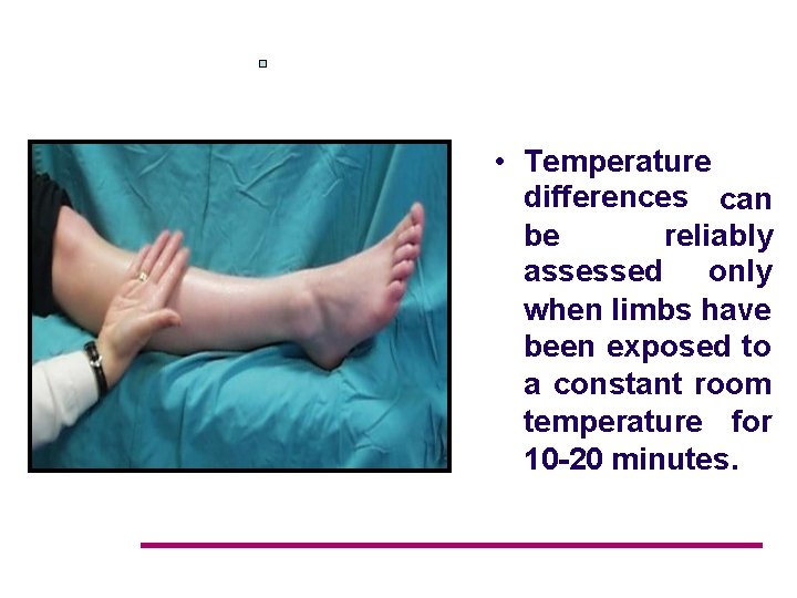 • Temperature differences can be reliably assessed only when limbs have been exposed  • Temperature differences can be reliably assessed only when limbs have been exposed