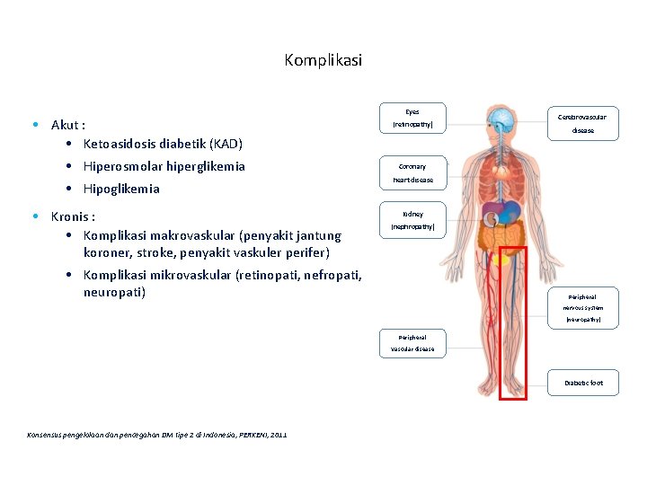 Komplikasi • Akut : • Ketoasidosis diabetik (KAD) • Hiperosmolar hiperglikemia • Hipoglikemia • Komplikasi • Akut : • Ketoasidosis diabetik (KAD) • Hiperosmolar hiperglikemia • Hipoglikemia •
