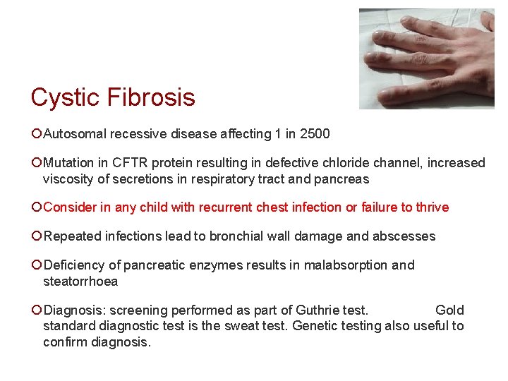 Cystic Fibrosis ¡ Autosomal recessive disease affecting 1 in 2500 ¡ Mutation in CFTR