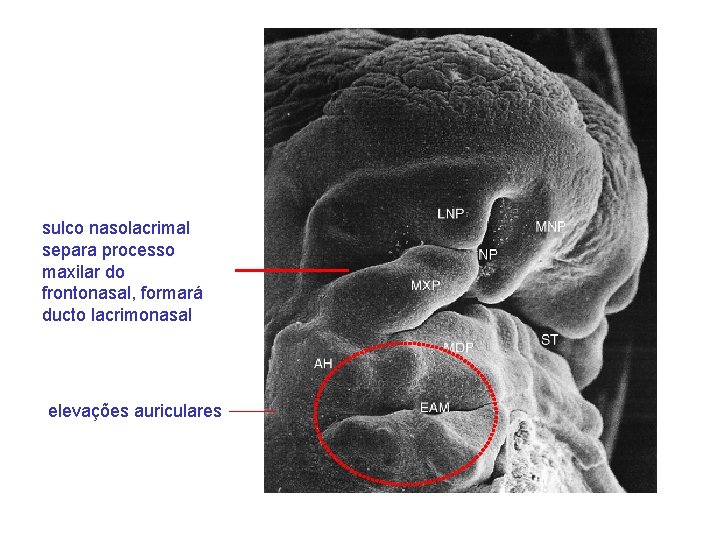 sulco nasolacrimal separa processo maxilar do frontonasal, formará ducto lacrimonasal elevações auriculares 