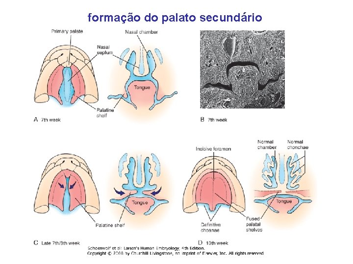 formação do palato secundário 